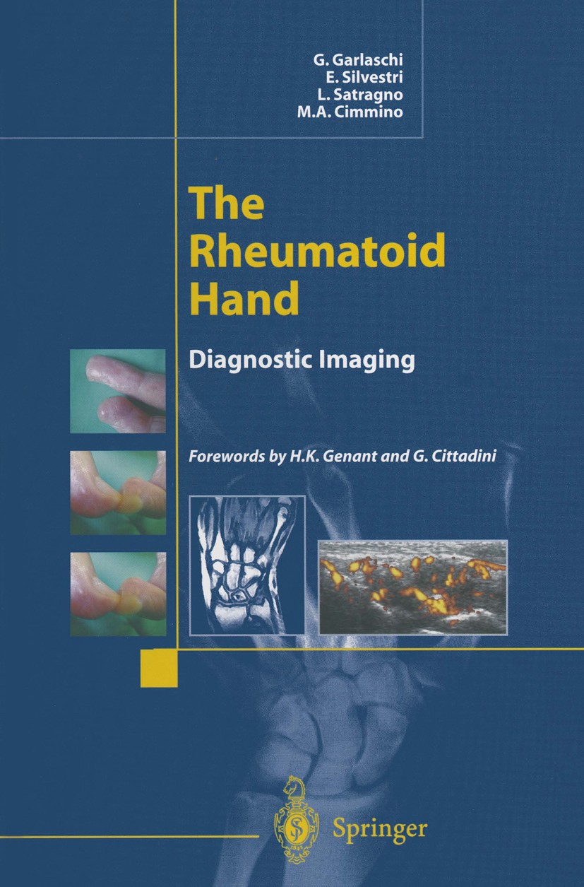 Titlebook: The Rheumatoid Hand; Diagnostic Imaging Giacomo Garlaschi,Enzo Silvestri,Marco Amedeo Cimm Book 2002 Springer-Verlag Italia, Milano 2002 Ar Titlebook: The Rheumatoid Hand; Diagnostic Imaging Giacomo Garlaschi,Enzo Silvestri,Marco Amedeo Cimm Book 2002 Springer-Verlag Italia, Milano 2002 Ar