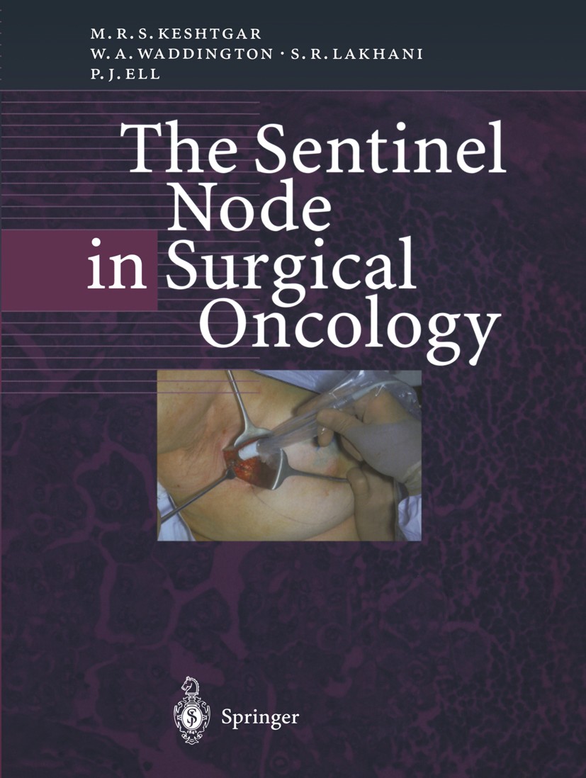 Titlebook: The Sentinel Node in Surgical Oncology; Mohammad R. S. Keshtgar,Wendy A. Waddington,Peter Book 1999 Springer-Verlag Berlin Heidelberg 199 Titlebook: The Sentinel Node in Surgical Oncology; Mohammad R. S. Keshtgar,Wendy A. Waddington,Peter Book 1999 Springer-Verlag Berlin Heidelberg 199