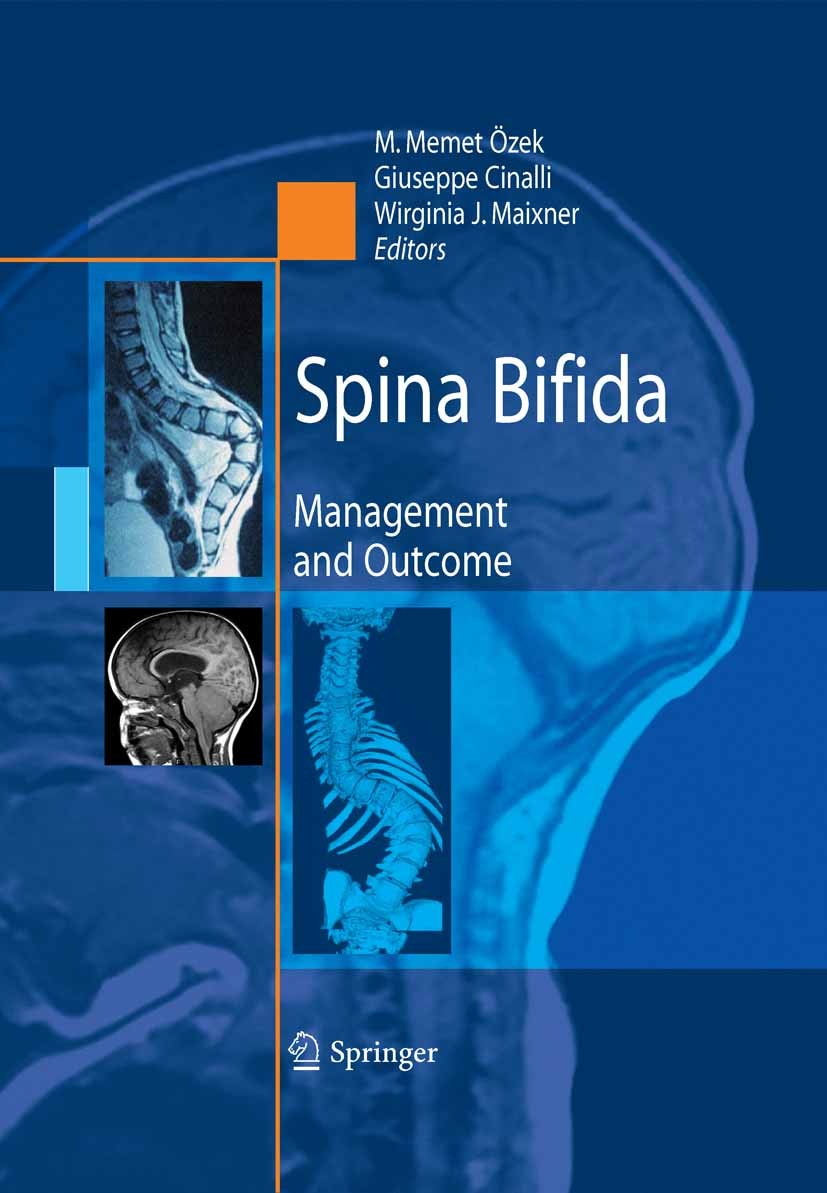 Titlebook: Spina Bifida; Management and Outco M. Memet Özek,Giuseppe Cinalli,Wirginia J. Maixner Book 2008 Springer-Verlag Milan 2008 Chiari malformat Titlebook: Spina Bifida; Management and Outco M. Memet Özek,Giuseppe Cinalli,Wirginia J. Maixner Book 2008 Springer-Verlag Milan 2008 Chiari malformat