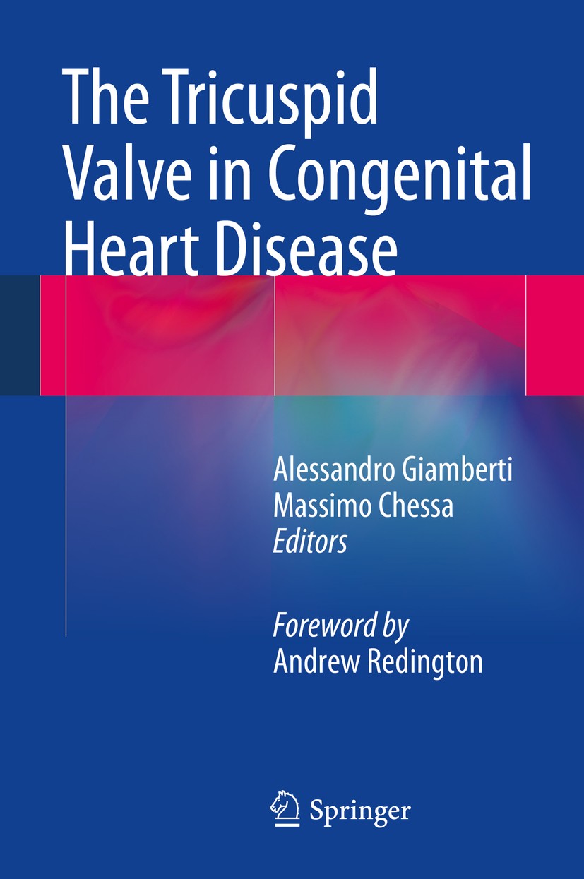Titlebook: The Tricuspid Valve in Congenital Heart Disease; Alessandro Giamberti,Massimo Chessa Book 2014 Springer-Verlag Italia 2014 Adult with cong Titlebook: The Tricuspid Valve in Congenital Heart Disease; Alessandro Giamberti,Massimo Chessa Book 2014 Springer-Verlag Italia 2014 Adult with cong