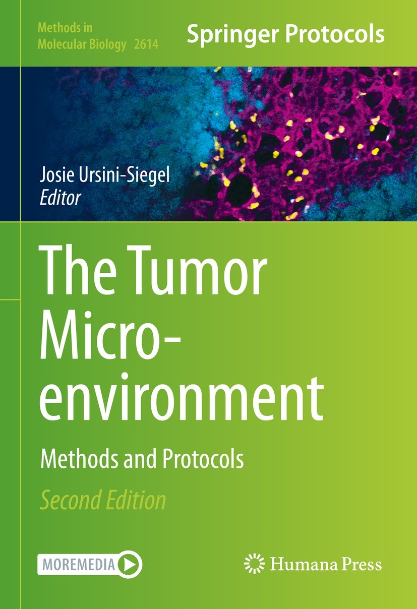 Titlebook: The Tumor Microenvironment; Methods and Protocol Josie Ursini-Siegel Book 2023Latest edition The Editor(s) (if applicable) and The Author(s Titlebook: The Tumor Microenvironment; Methods and Protocol Josie Ursini-Siegel Book 2023Latest edition The Editor(s) (if applicable) and The Author(s