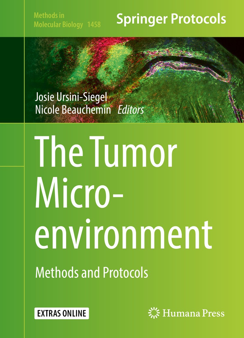 Titlebook: The Tumor Microenvironment; Methods and Protocol Josie Ursini-Siegel,Nicole Beauchemin Book 2016 Springer Science+Business Media New York 2 Titlebook: The Tumor Microenvironment; Methods and Protocol Josie Ursini-Siegel,Nicole Beauchemin Book 2016 Springer Science+Business Media New York 2