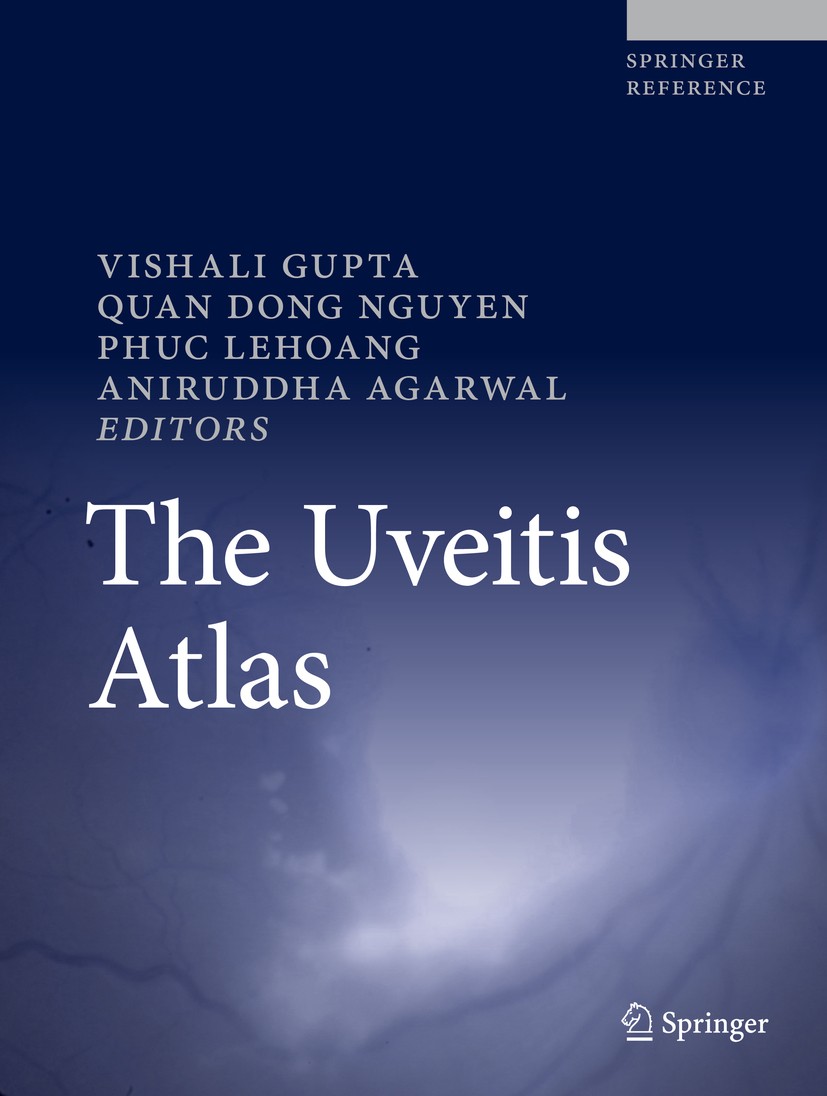 Titlebook: The Uveitis Atlas; Vishali Gupta,Quan Dong Nguyen,Aniruddha Agarwal Reference work 2020 Springer Nature India Private Limited 2020 HIV-rel Titlebook: The Uveitis Atlas; Vishali Gupta,Quan Dong Nguyen,Aniruddha Agarwal Reference work 2020 Springer Nature India Private Limited 2020 HIV-rel