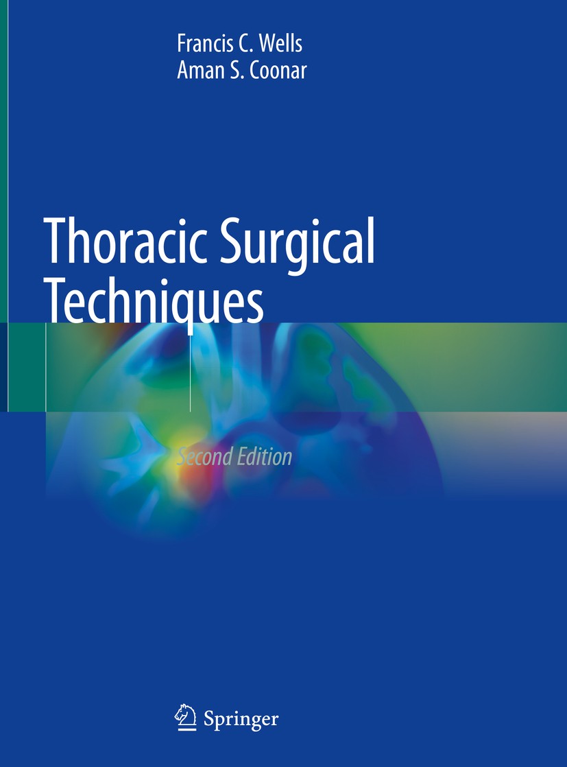 Titlebook: Thoracic Surgical Techniques; Francis C. Wells,Aman S. Coonar Book 2018Latest edition Springer International Publishing AG, part of Spring Titlebook: Thoracic Surgical Techniques; Francis C. Wells,Aman S. Coonar Book 2018Latest edition Springer International Publishing AG, part of Spring