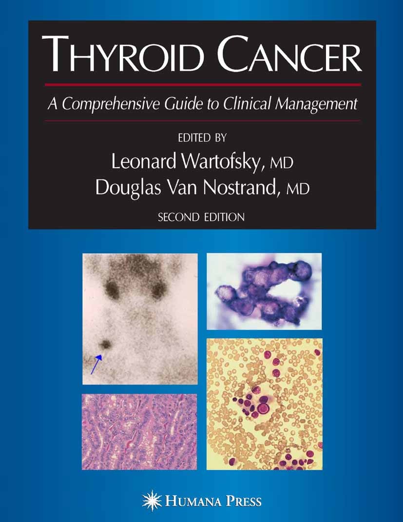 Titlebook: Thyroid Cancer; A Comprehensive Guid Leonard Wartofsky,Douglas Nostrand Book 20062nd edition Humana Press 2006 Staging.apoptosis.carcinoma. Titlebook: Thyroid Cancer; A Comprehensive Guid Leonard Wartofsky,Douglas Nostrand Book 20062nd edition Humana Press 2006 Staging.apoptosis.carcinoma.