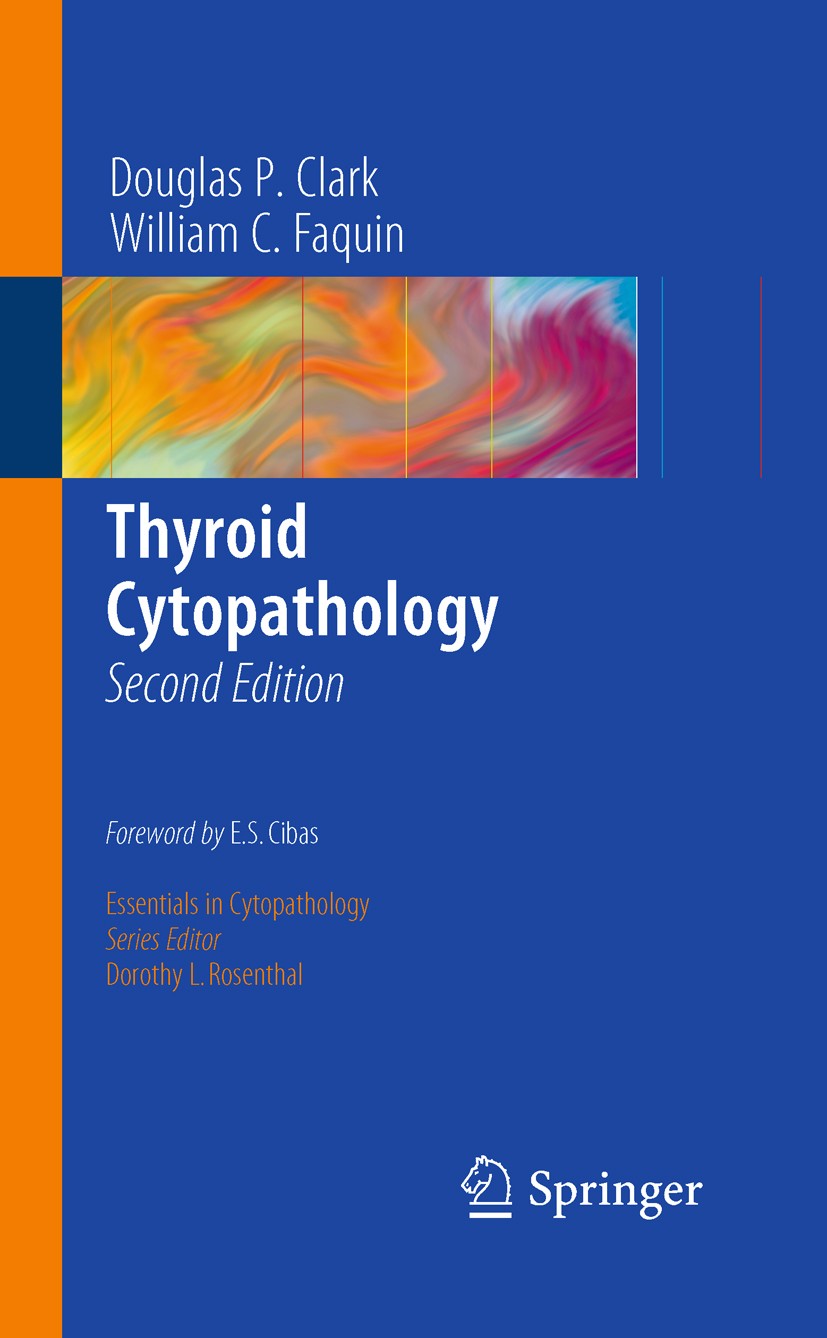 Titlebook: Thyroid Cytopathology; Douglas P. Clark,William C. Faquin Book 2010Latest edition Springer Science+Business Media, LLC 2010 Algorithm.Diag Titlebook: Thyroid Cytopathology; Douglas P. Clark,William C. Faquin Book 2010Latest edition Springer Science+Business Media, LLC 2010 Algorithm.Diag