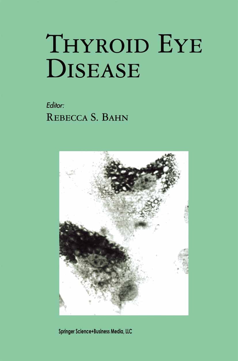 Titlebook: Thyroid Eye Disease; Rebecca S. Bahn Book 2001 Kluwer Academic Publishers 2001 Antigen.autoimmunity.cytokine.eye.pathogenesis.diabetes Titlebook: Thyroid Eye Disease; Rebecca S. Bahn Book 2001 Kluwer Academic Publishers 2001 Antigen.autoimmunity.cytokine.eye.pathogenesis.diabetes