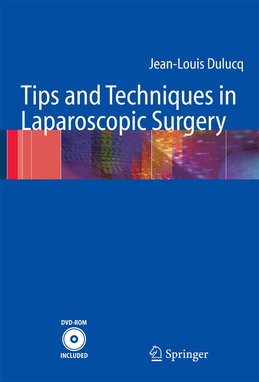 Titlebook: Tips and Techniques in Laparoscopic Surgery; Jean-Louis Dulucq Book 2005 Springer-Verlag Berlin Heidelberg 2005 Abdominal Surgery.Gastroin Titlebook: Tips and Techniques in Laparoscopic Surgery; Jean-Louis Dulucq Book 2005 Springer-Verlag Berlin Heidelberg 2005 Abdominal Surgery.Gastroin