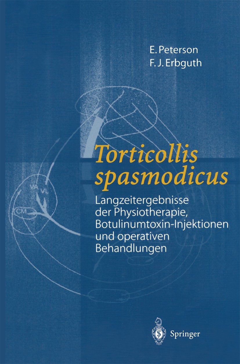 Titlebook: Torticollis spasmodicus; Langzeitergebnisse d Eckhardt. Peterson,Frank J. Erbguth Book 2001 Springer-Verlag Berlin Heidelberg 2001 Dekompre Titlebook: Torticollis spasmodicus; Langzeitergebnisse d Eckhardt. Peterson,Frank J. Erbguth Book 2001 Springer-Verlag Berlin Heidelberg 2001 Dekompre