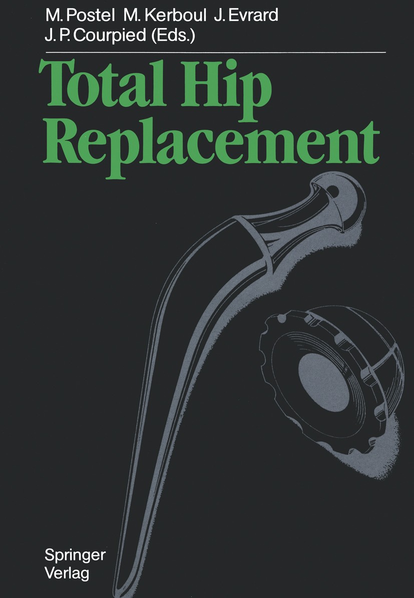 Titlebook: Total Hip Replacement; Michel Postel,Marcel Kerboul,Jean Pierre Courpied Book 1987 Springer-Verlag Berlin Heidelberg 1987 arthroplasty.bon Titlebook: Total Hip Replacement; Michel Postel,Marcel Kerboul,Jean Pierre Courpied Book 1987 Springer-Verlag Berlin Heidelberg 1987 arthroplasty.bon