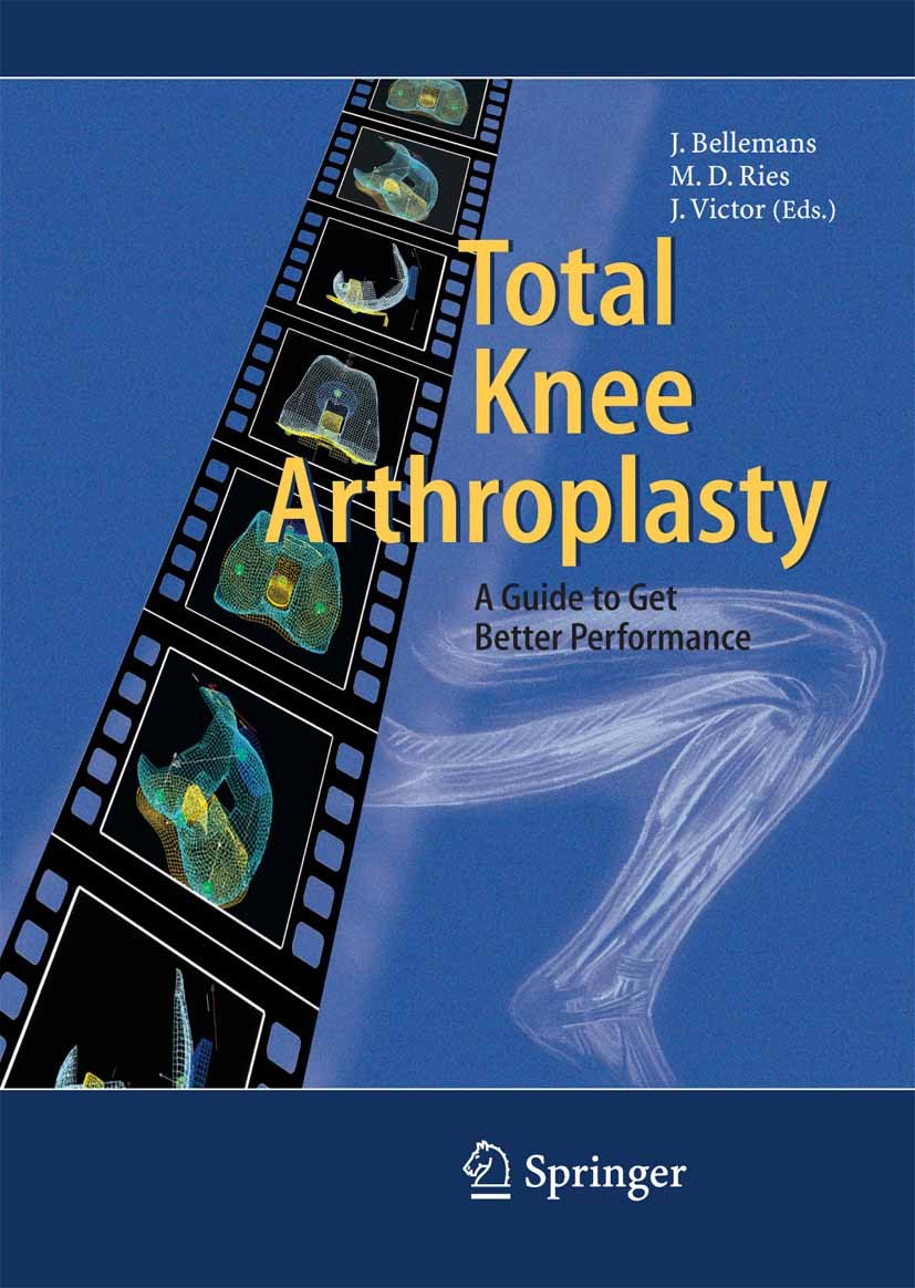 Titlebook: Total Knee Arthroplasty; A Guide to Get Bette Johan Bellemans (Professor),Michael D. Ries (Profe Book 2005 Springer-Verlag Berlin Heidelber Titlebook: Total Knee Arthroplasty; A Guide to Get Bette Johan Bellemans (Professor),Michael D. Ries (Profe Book 2005 Springer-Verlag Berlin Heidelber