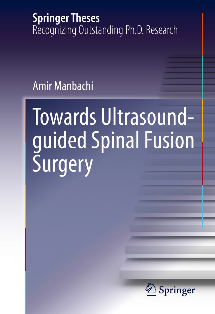 Titlebook: Towards Ultrasound-guided Spinal Fusion Surgery; Amir Manbachi Book 2016 Springer International Publishing Switzerland 2016 Radial imaging Titlebook: Towards Ultrasound-guided Spinal Fusion Surgery; Amir Manbachi Book 2016 Springer International Publishing Switzerland 2016 Radial imaging