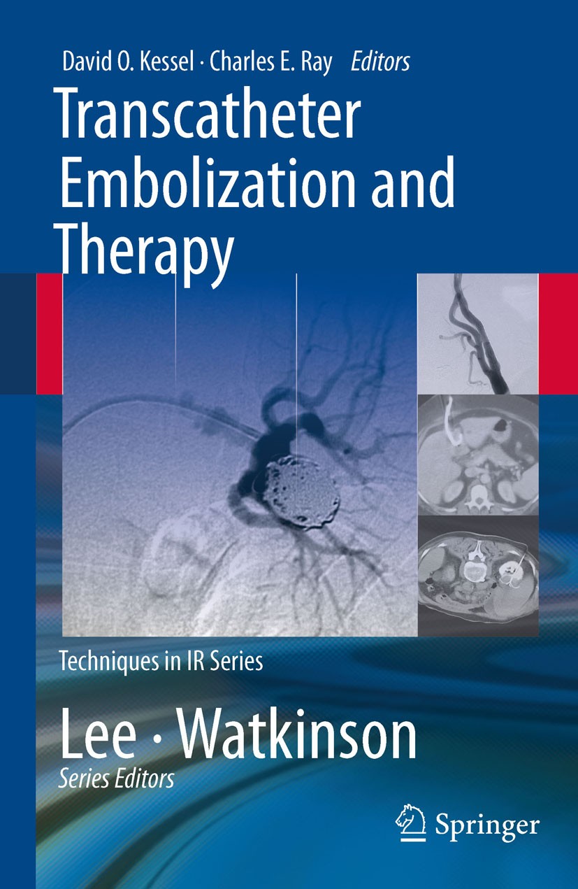 Titlebook: Transcatheter Embolization and Therapy; David Kessel,Charles Ray Book 2009 Springer-Verlag London 2009 Tumor.aneurysm.bone.interventional Titlebook: Transcatheter Embolization and Therapy; David Kessel,Charles Ray Book 2009 Springer-Verlag London 2009 Tumor.aneurysm.bone.interventional