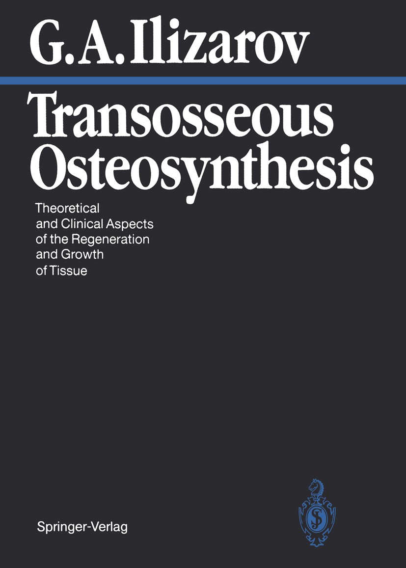 Titlebook: Transosseous Osteosynthesis; Theoretical and Clin Gavriil A. Ilizarov Book 1992 Springer-Verlag Berlin Heidelberg 1992 External Fixation.Ex Titlebook: Transosseous Osteosynthesis; Theoretical and Clin Gavriil A. Ilizarov Book 1992 Springer-Verlag Berlin Heidelberg 1992 External Fixation.Ex