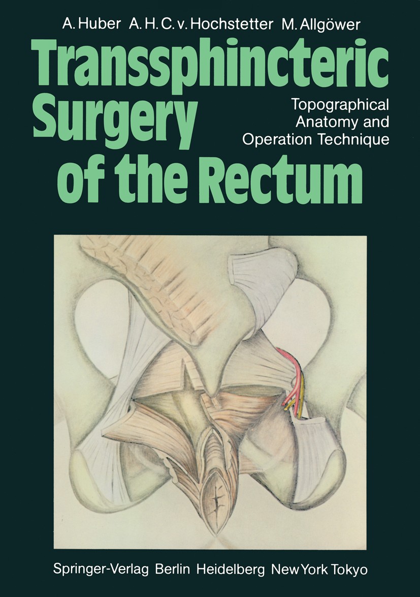 Titlebook: Transsphincteric Surgery of the Rectum; Topographical Anatom Andreas Huber,Arthur H. C. Hochstetter,Martin Allg Book 1984 Springer-Verlag B Titlebook: Transsphincteric Surgery of the Rectum; Topographical Anatom Andreas Huber,Arthur H. C. Hochstetter,Martin Allg Book 1984 Springer-Verlag B