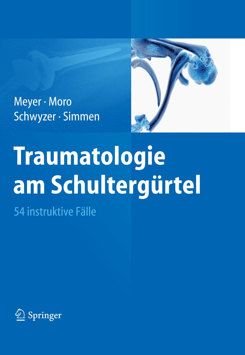 Titlebook: Traumatologie am Schultergürtel; 54 instruktive Fälle Rainer-Peter Meyer (Facharzt für Orthopädische Chi Book 2011 Springer Berlin Heidelbe Titlebook: Traumatologie am Schultergürtel; 54 instruktive Fälle Rainer-Peter Meyer (Facharzt für Orthopädische Chi Book 2011 Springer Berlin Heidelbe