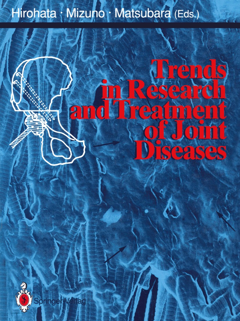 Titlebook: Trends in Research and Treatment of Joint Diseases; Kazushi Hirohata (Chairman of Orlhopedic Surgery), Book 1992 Springer-Verlag Tokyo 199 Titlebook: Trends in Research and Treatment of Joint Diseases; Kazushi Hirohata (Chairman of Orlhopedic Surgery), Book 1992 Springer-Verlag Tokyo 199
