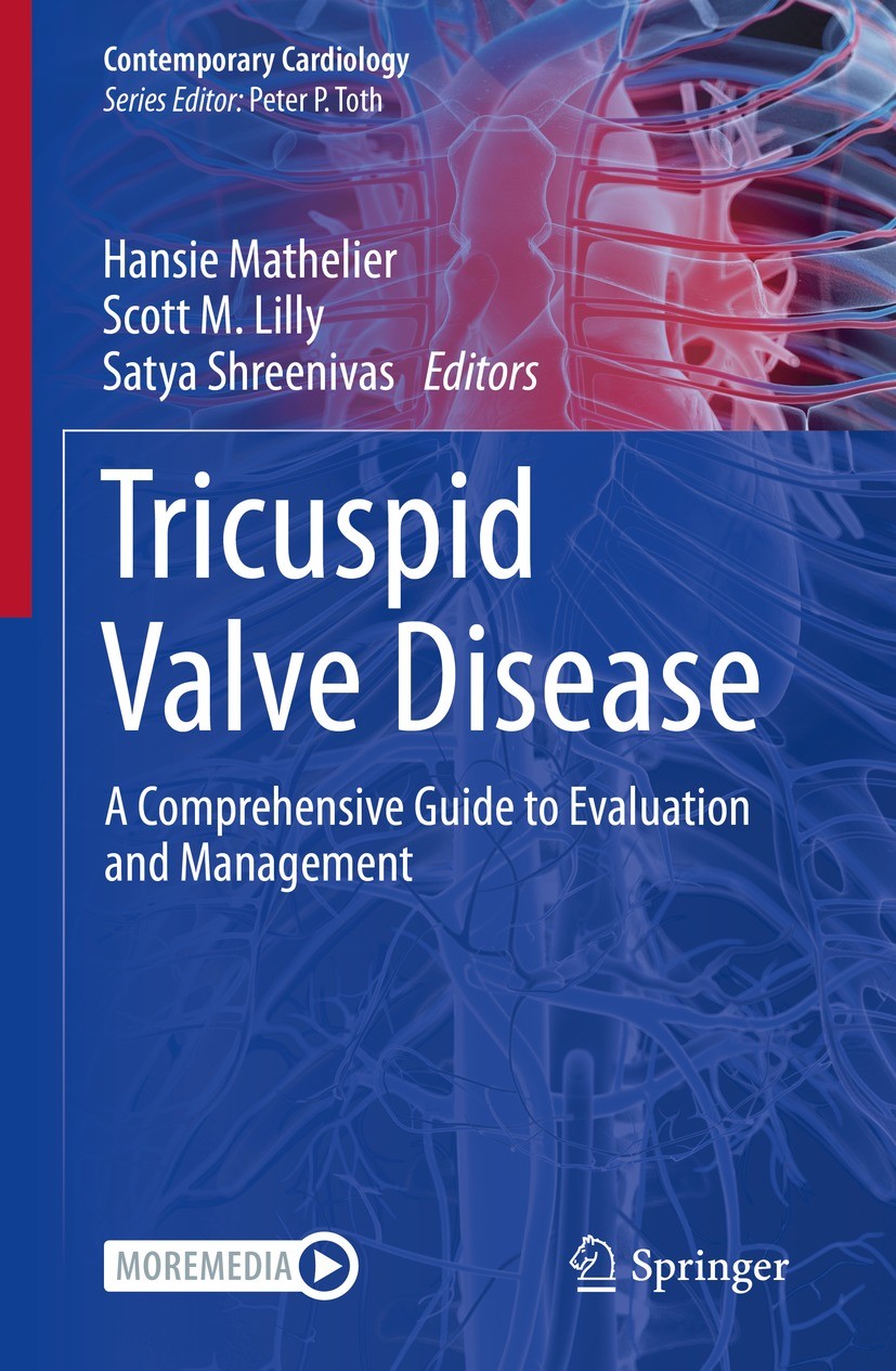 Titlebook: Tricuspid Valve Disease; A Comprehensive Guid Hansie Mathelier,Scott M. Lilly,Satya Shreenivas Book 2022 Springer Nature Switzerland AG 202 Titlebook: Tricuspid Valve Disease; A Comprehensive Guid Hansie Mathelier,Scott M. Lilly,Satya Shreenivas Book 2022 Springer Nature Switzerland AG 202