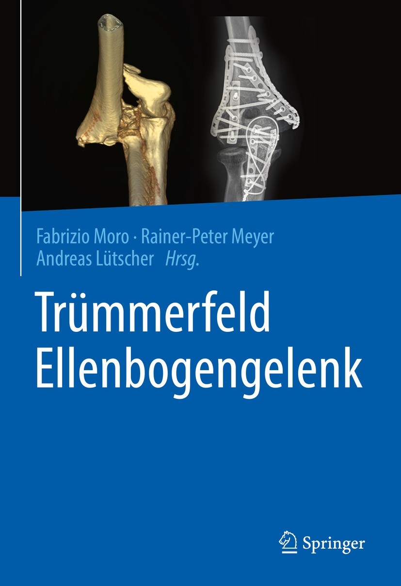 Titlebook: Trümmerfeld Ellenbogengelenk; Fabrizio Moro,Rainer-Peter Meyer,Andreas Lütscher Book 2022 Der/die Herausgeber bzw. der/die Autor(en), exkl Titlebook: Trümmerfeld Ellenbogengelenk; Fabrizio Moro,Rainer-Peter Meyer,Andreas Lütscher Book 2022 Der/die Herausgeber bzw. der/die Autor(en), exkl
