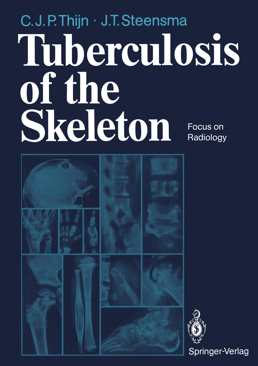 Titlebook: Tuberculosis of the Skeleton; Focus on Radiology Cornelis J. P. Thijn,Jieldouw T. Steensma Book 1990 Springer-Verlag Berlin Heidelberg 1990 Titlebook: Tuberculosis of the Skeleton; Focus on Radiology Cornelis J. P. Thijn,Jieldouw T. Steensma Book 1990 Springer-Verlag Berlin Heidelberg 1990