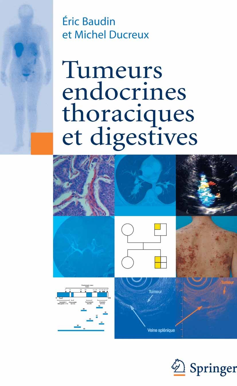 Titlebook: Tumeurs endocrines thoraciques et digestives; Éric Baudin,Michel Ducreux Book 2008Latest edition Springer-Verlag Paris 2008 Bilan des ilot Titlebook: Tumeurs endocrines thoraciques et digestives; Éric Baudin,Michel Ducreux Book 2008Latest edition Springer-Verlag Paris 2008 Bilan des ilot