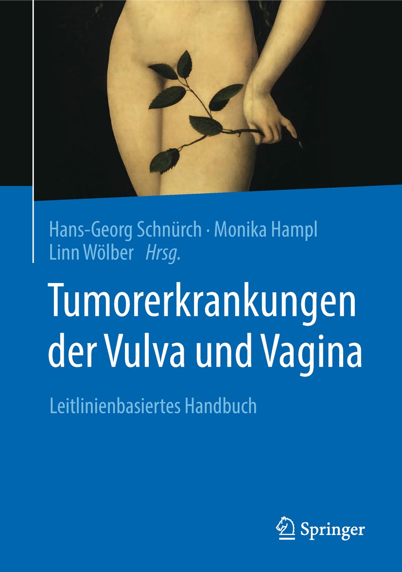 Titlebook: Tumorerkrankungen der Vulva und Vagina; Leitlinienbasiertes Hans-Georg Schnürch,Monika Hampl,Linn Wölber Book 2018 Springer-Verlag GmbH De Titlebook: Tumorerkrankungen der Vulva und Vagina; Leitlinienbasiertes Hans-Georg Schnürch,Monika Hampl,Linn Wölber Book 2018 Springer-Verlag GmbH De