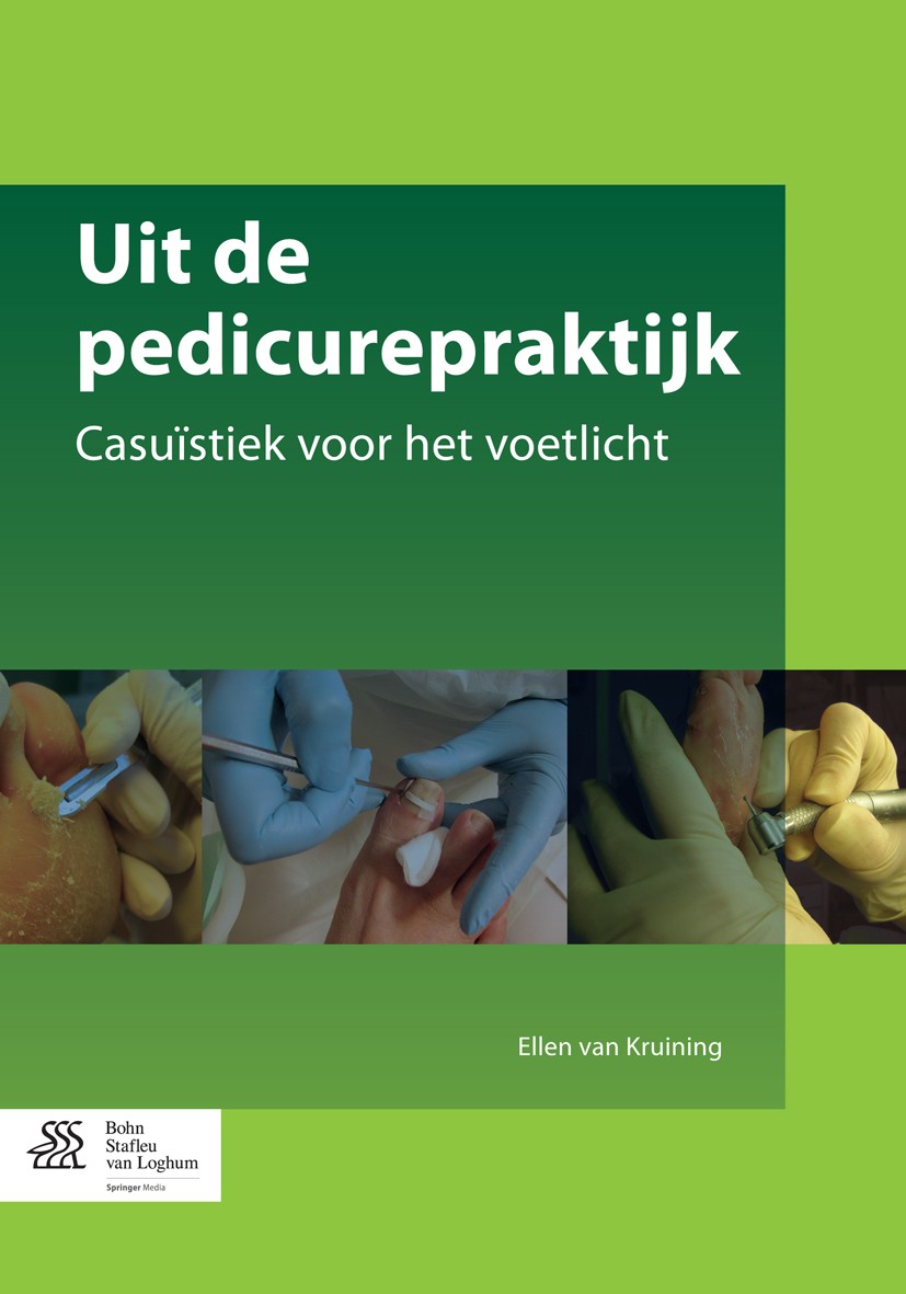Titlebook: Uit de pedicurepraktijk; Casuïstiek voor het Ellen van Kruining Book 2015Latest edition Bohn Stafleu van Loghum 2015 Basispedicure.Diabeti Titlebook: Uit de pedicurepraktijk; Casuïstiek voor het Ellen van Kruining Book 2015Latest edition Bohn Stafleu van Loghum 2015 Basispedicure.Diabeti