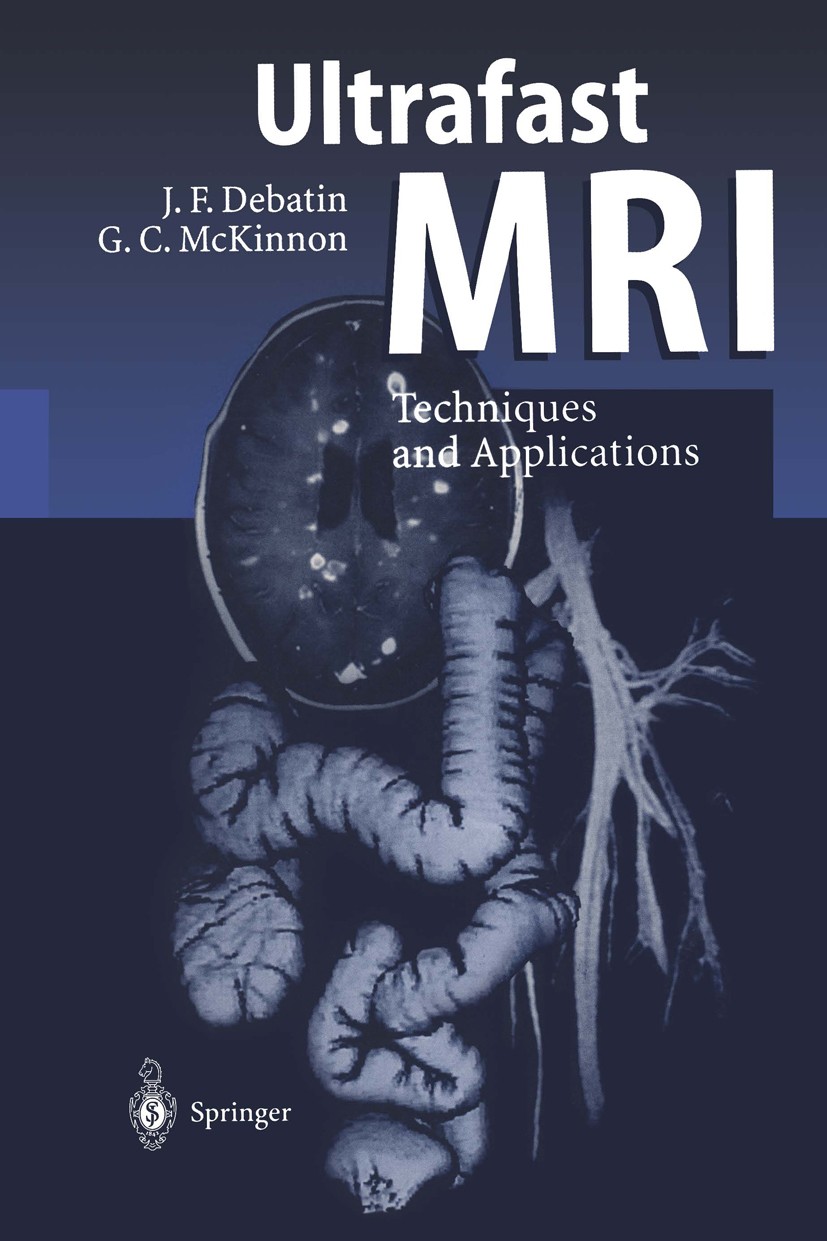Titlebook: Ultrafast MRI; Techniques and Appli Jörg F. Debatin,Graeme C. McKinnon Book 1998 Springer-Verlag Berlin Heidelberg 1998 Magnetresonanztomog Titlebook: Ultrafast MRI; Techniques and Appli Jörg F. Debatin,Graeme C. McKinnon Book 1998 Springer-Verlag Berlin Heidelberg 1998 Magnetresonanztomog
