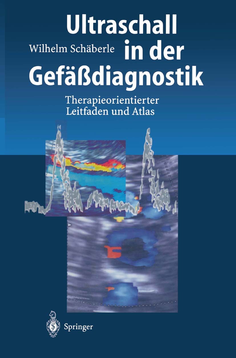 Titlebook: Ultraschall in der Gefäßdiagnostik; Therapieorientierter Wilhelm Schäberle Book 19981st edition Springer-Verlag Berlin Heidelberg 1998 Angi Titlebook: Ultraschall in der Gefäßdiagnostik; Therapieorientierter Wilhelm Schäberle Book 19981st edition Springer-Verlag Berlin Heidelberg 1998 Angi