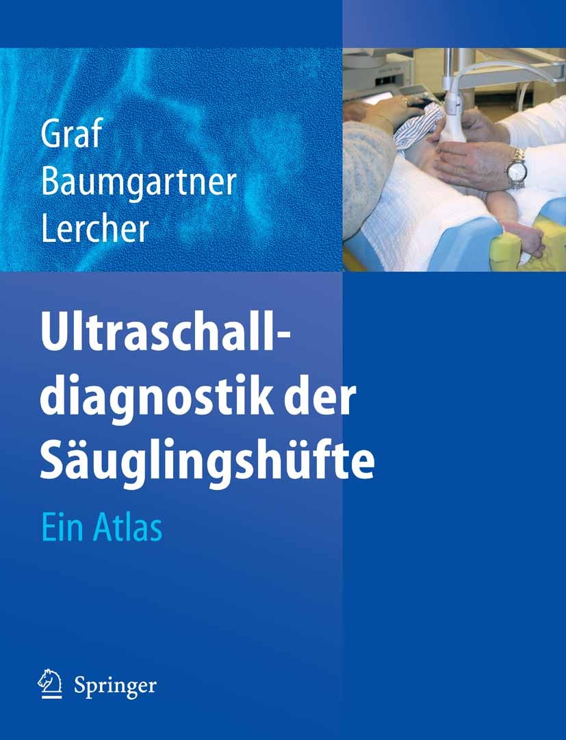 Titlebook: Ultraschalldiagnostik der Säuglingshüfte; Ein Atlas Reinhard Graf,Florian Baumgartner,Kurt Lercher Book 20061st edition Springer-Verlag Ber Titlebook: Ultraschalldiagnostik der Säuglingshüfte; Ein Atlas Reinhard Graf,Florian Baumgartner,Kurt Lercher Book 20061st edition Springer-Verlag Ber