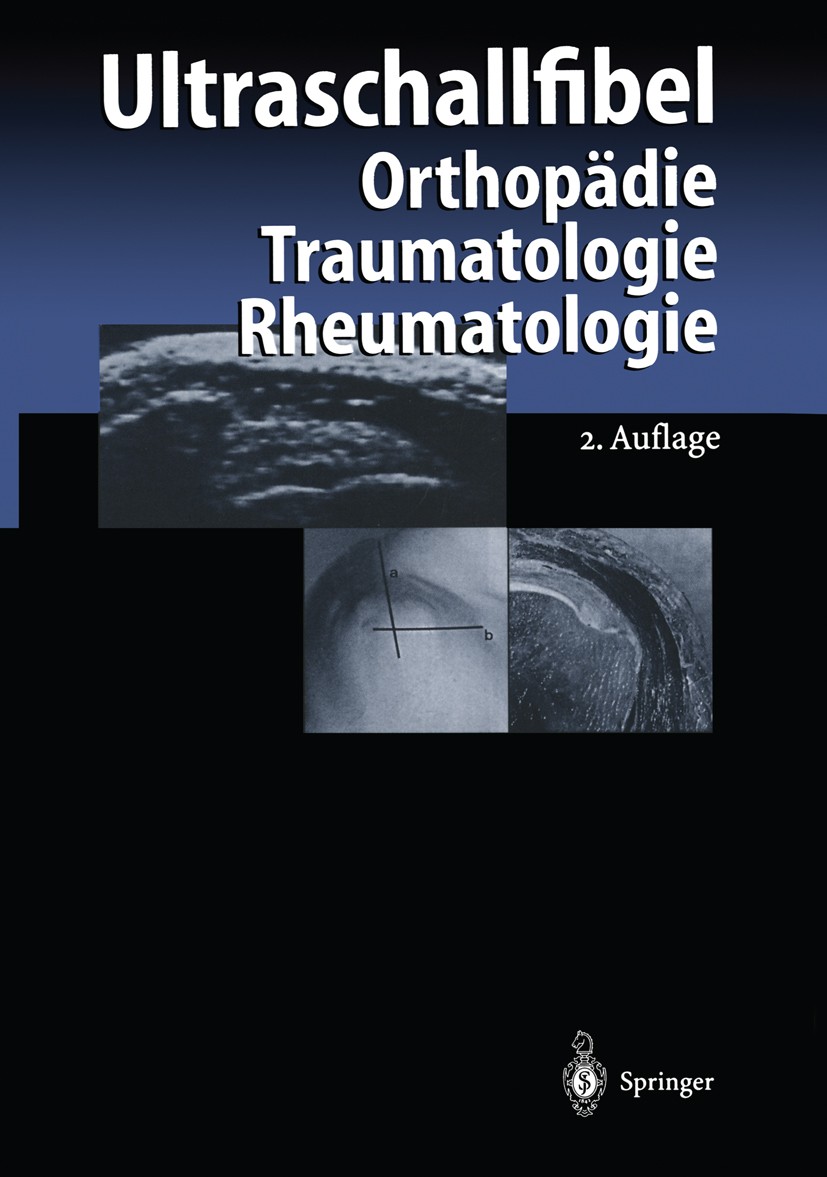 Titlebook: Ultraschallfibel; Orthopädie Traumatol Ulrich Harland,Horst Sattler Book 1999Latest edition Springer-Verlag Berlin Heidelberg 1999 Diagnost Titlebook: Ultraschallfibel; Orthopädie Traumatol Ulrich Harland,Horst Sattler Book 1999Latest edition Springer-Verlag Berlin Heidelberg 1999 Diagnost