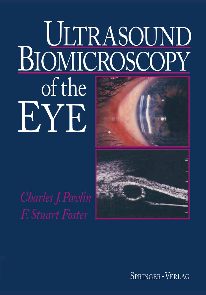 Titlebook: Ultrasound Biomicroscopy of the Eye; Charles J. Pavlin,FS Foster Book 1995 Springer-Verlag New York, Inc. 1995 Biomicroscopy.Tumor.anatomy Titlebook: Ultrasound Biomicroscopy of the Eye; Charles J. Pavlin,FS Foster Book 1995 Springer-Verlag New York, Inc. 1995 Biomicroscopy.Tumor.anatomy