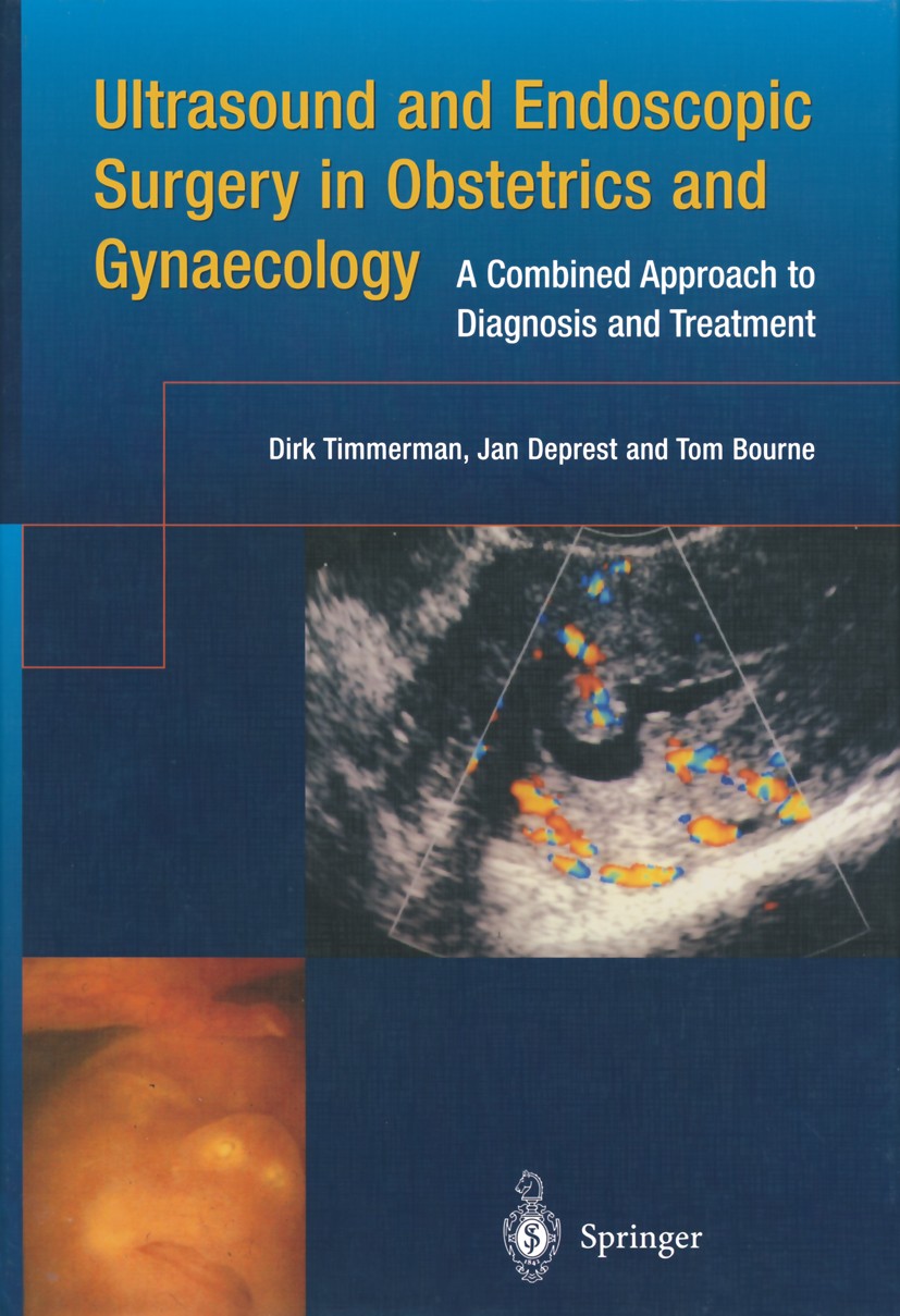 Titlebook: Ultrasound and Endoscopic Surgery in Obstetrics and Gynaecology; A Combined Approach Dirk Timmerman,Jan Deprest,Tom Bourne Book 2003 Sprin Titlebook: Ultrasound and Endoscopic Surgery in Obstetrics and Gynaecology; A Combined Approach Dirk Timmerman,Jan Deprest,Tom Bourne Book 2003 Sprin