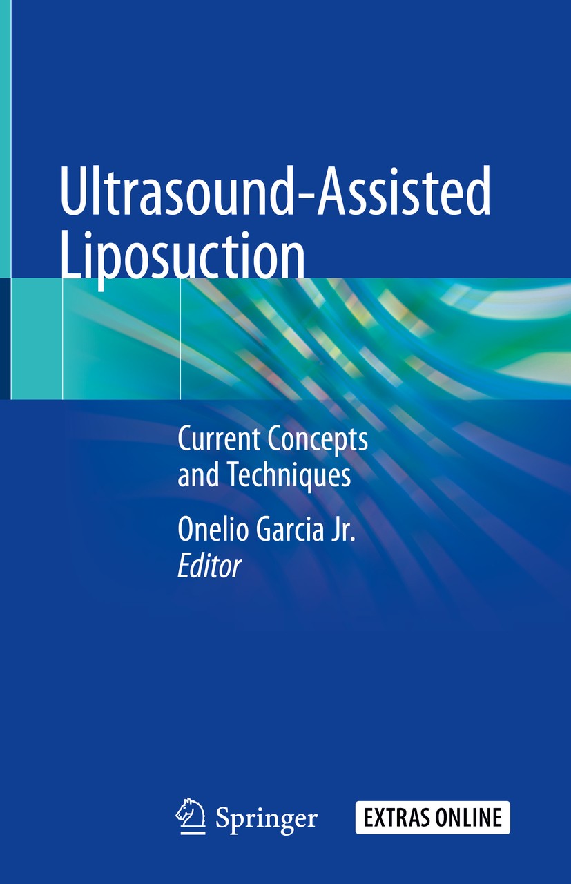 Titlebook: Ultrasound-Assisted Liposuction; Current Concepts and Onelio Garcia Jr. Book 2020 Springer Nature Switzerland AG 2020 liposuction.body cont Titlebook: Ultrasound-Assisted Liposuction; Current Concepts and Onelio Garcia Jr. Book 2020 Springer Nature Switzerland AG 2020 liposuction.body cont