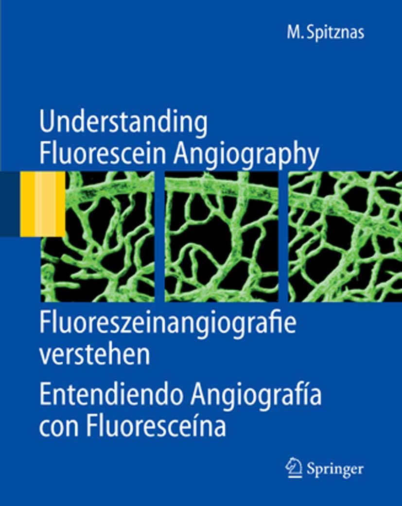 Titlebook: Understanding Fluorescein Angiography, Fluoreszeinangiografie verstehen, Entendiendo Angiografía con; Manfred Spitznas Book 2006 Springer- Titlebook: Understanding Fluorescein Angiography, Fluoreszeinangiografie verstehen, Entendiendo Angiografía con; Manfred Spitznas Book 2006 Springer-