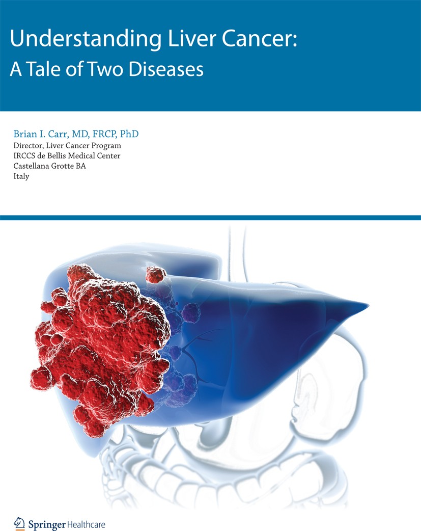 Titlebook: Understanding Liver Cancer; A Tale of Two Diseas Brian I. Carr Book 2014 Springer Healthcare 2014 Cirrhosis.Hepatitis C.Hepatocellular Carc Titlebook: Understanding Liver Cancer; A Tale of Two Diseas Brian I. Carr Book 2014 Springer Healthcare 2014 Cirrhosis.Hepatitis C.Hepatocellular Carc