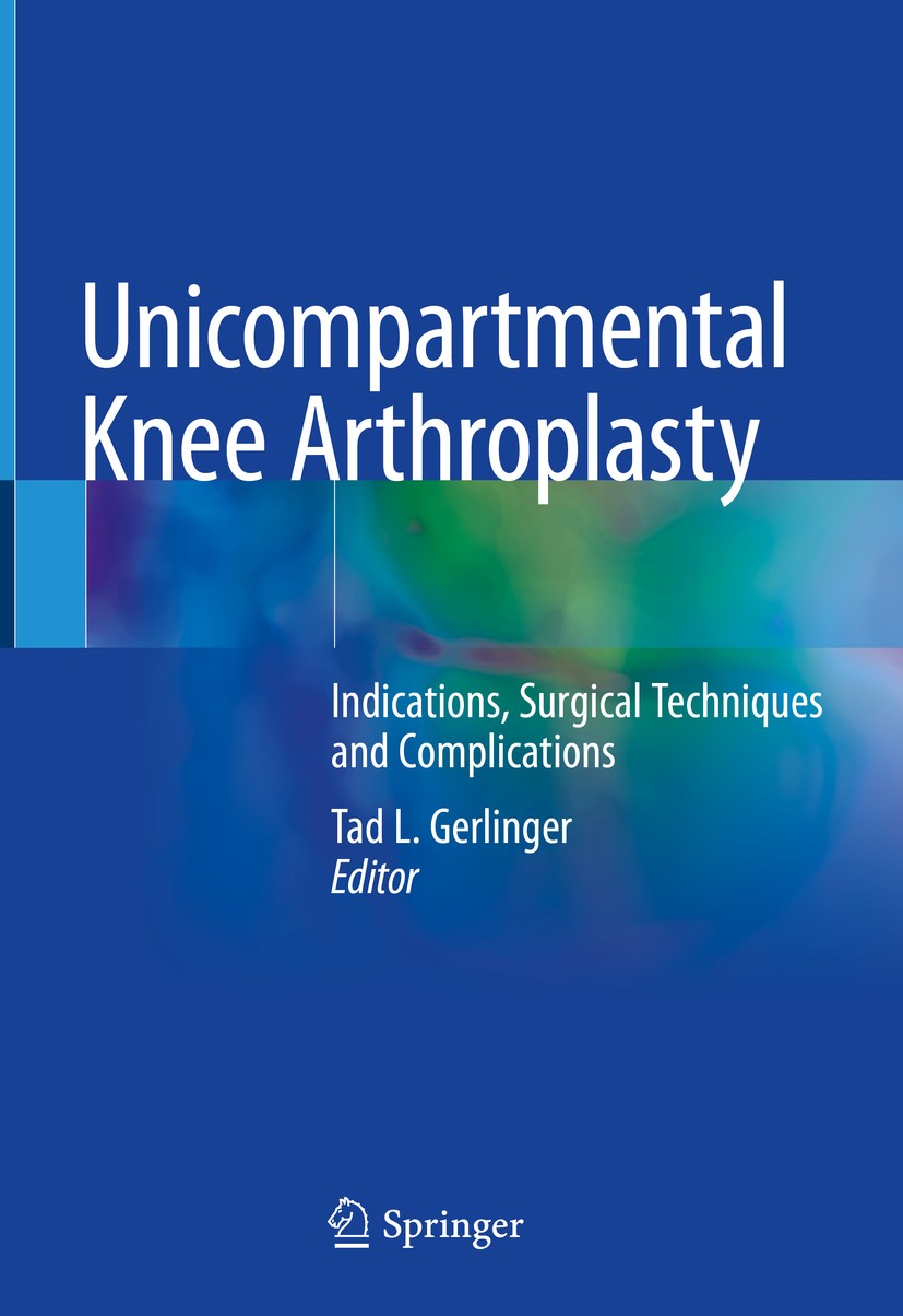 Titlebook: Unicompartmental Knee Arthroplasty; Indications, Surgica Tad L. Gerlinger Book 2020 Springer Nature Switzerland AG 2020 Anterior cruciate l Titlebook: Unicompartmental Knee Arthroplasty; Indications, Surgica Tad L. Gerlinger Book 2020 Springer Nature Switzerland AG 2020 Anterior cruciate l
