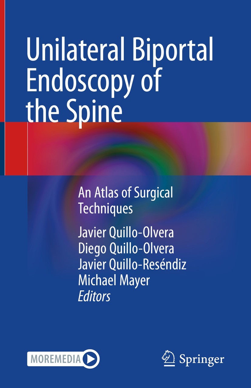 Titlebook: Unilateral Biportal Endoscopy of the Spine; An Atlas of Surgical Javier Quillo-Olvera,Diego Quillo-Olvera,Michael M Book 2022 The Editor(s) Titlebook: Unilateral Biportal Endoscopy of the Spine; An Atlas of Surgical Javier Quillo-Olvera,Diego Quillo-Olvera,Michael M Book 2022 The Editor(s)