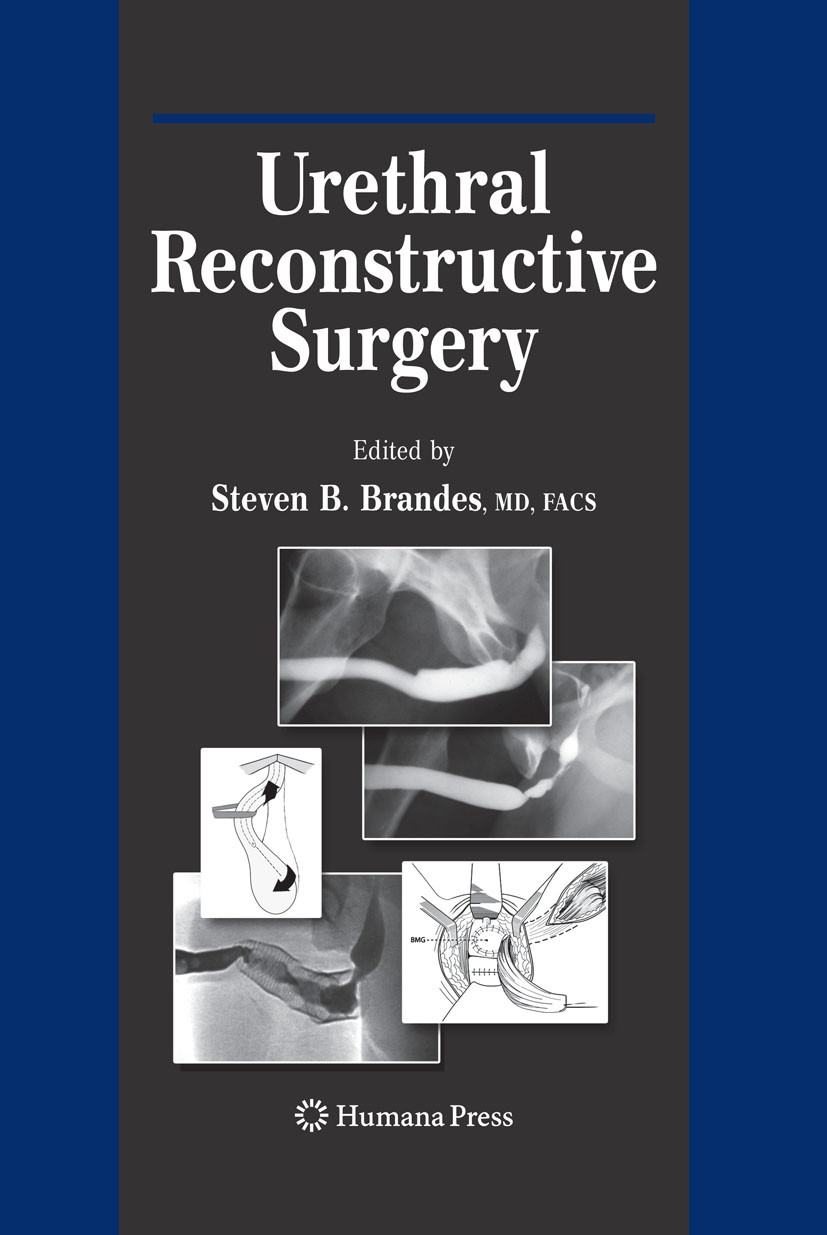 Titlebook: Urethral Reconstructive Surgery; Steven B. Brandes Book 20081st edition Humana Press 2008 Hypospadias.LSA.Panurethral Strictures.Plastic S Titlebook: Urethral Reconstructive Surgery; Steven B. Brandes Book 20081st edition Humana Press 2008 Hypospadias.LSA.Panurethral Strictures.Plastic S