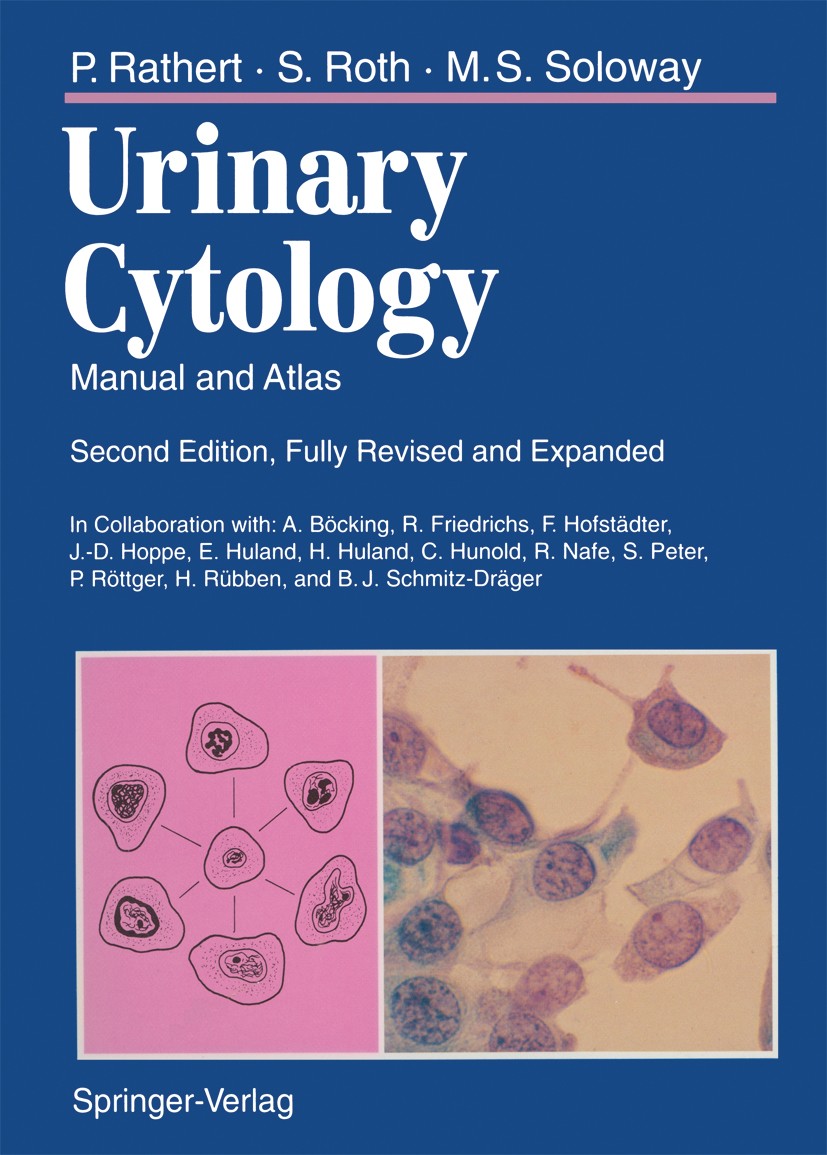 Titlebook: Urinary Cytology; Manual and Atlas Peter Rathert,Stephan Roth,Mark S. Soloway Book 19932nd edition Springer-Verlag Berlin Heidelberg 1993 B Titlebook: Urinary Cytology; Manual and Atlas Peter Rathert,Stephan Roth,Mark S. Soloway Book 19932nd edition Springer-Verlag Berlin Heidelberg 1993 B