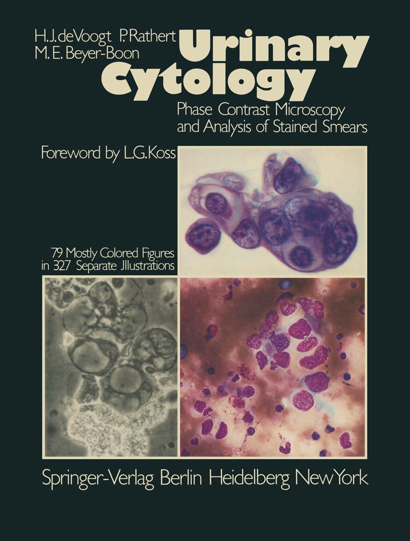 Titlebook: Urinary Cytology; Phase Contrast Micro Herman J. Voogt,Peter Rathert,Mathilde E. Beyer-Bo Book 19771st edition Springer-Verlag, Berlin · He Titlebook: Urinary Cytology; Phase Contrast Micro Herman J. Voogt,Peter Rathert,Mathilde E. Beyer-Bo Book 19771st edition Springer-Verlag, Berlin · He