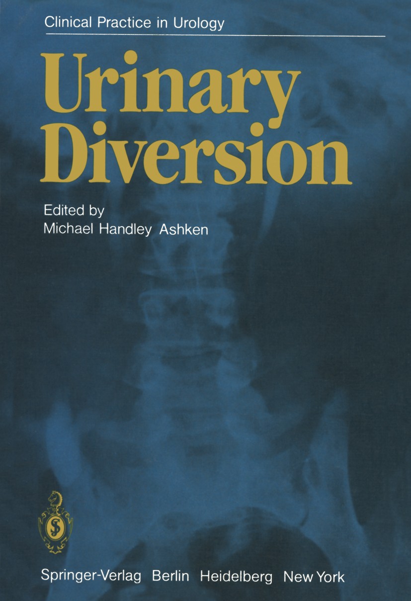 Titlebook: Urinary Diversion; Michael Handley Ashken (Consultant Urologist) Book 1982 Springer-Verlag Berlin Heidelberg 1982 Harnableitung.developmen Titlebook: Urinary Diversion; Michael Handley Ashken (Consultant Urologist) Book 1982 Springer-Verlag Berlin Heidelberg 1982 Harnableitung.developmen