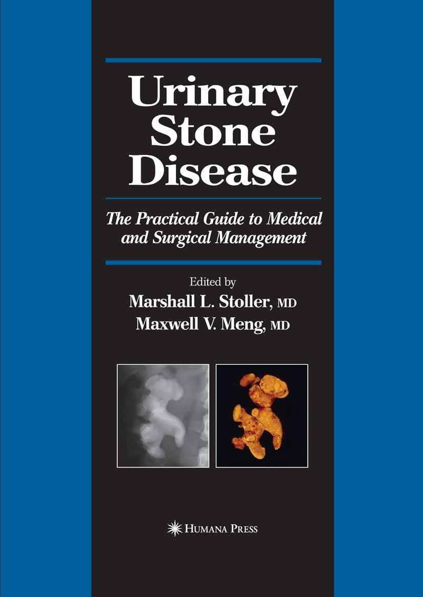 Titlebook: Urinary Stone Disease; The Practical Guide Marshall L. Stoller,Maxwell V. Meng Book 2007 Humana Press 2007 kidney.prevention.prostate.shoc Titlebook: Urinary Stone Disease; The Practical Guide Marshall L. Stoller,Maxwell V. Meng Book 2007 Humana Press 2007 kidney.prevention.prostate.shoc