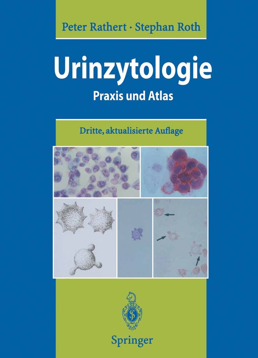 Titlebook: Urinzytologie; Praxis und Atlas Peter Rathert,Stephan Roth Book 19953rd edition Springer-Verlag Berlin Heidelberg 1995 Blasenkarzinom.Blase Titlebook: Urinzytologie; Praxis und Atlas Peter Rathert,Stephan Roth Book 19953rd edition Springer-Verlag Berlin Heidelberg 1995 Blasenkarzinom.Blase