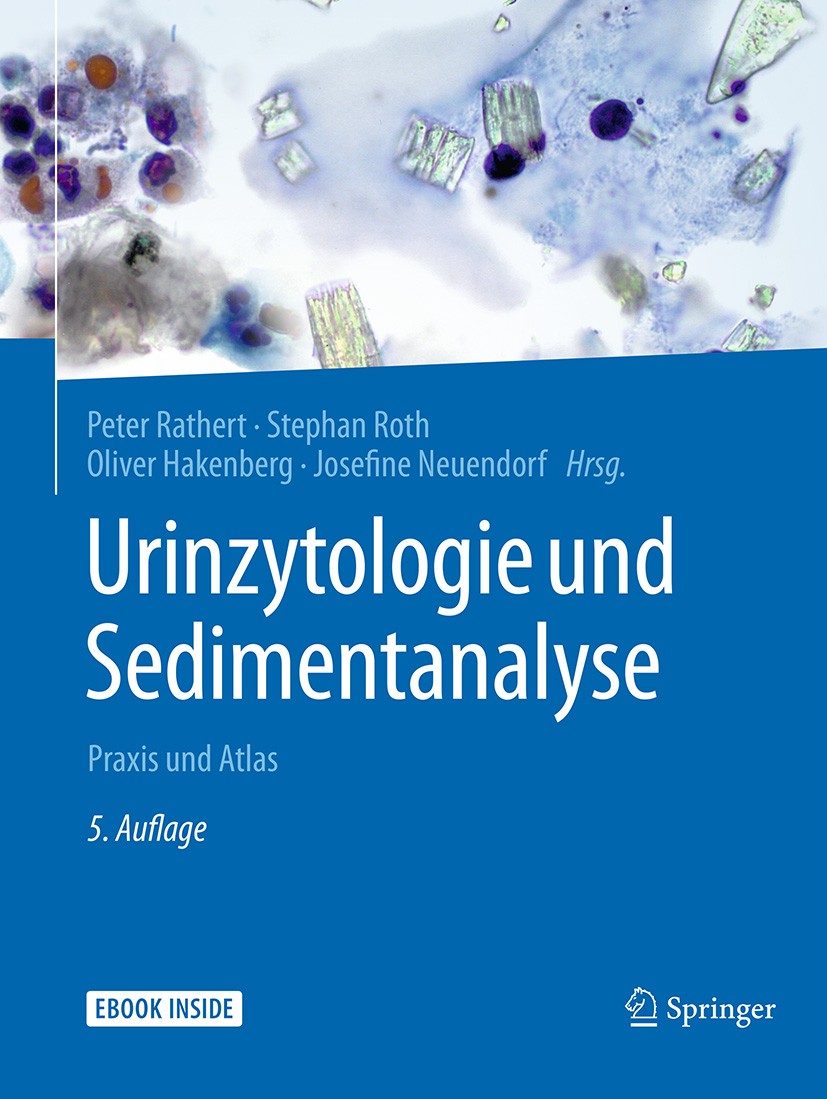 Titlebook: Urinzytologie und Sedimentanalyse; Praxis und Atlas Peter Rathert,Stephan Roth,Josefine Neuendorf Book 2018Latest edition Springer-Verlag G Titlebook: Urinzytologie und Sedimentanalyse; Praxis und Atlas Peter Rathert,Stephan Roth,Josefine Neuendorf Book 2018Latest edition Springer-Verlag G