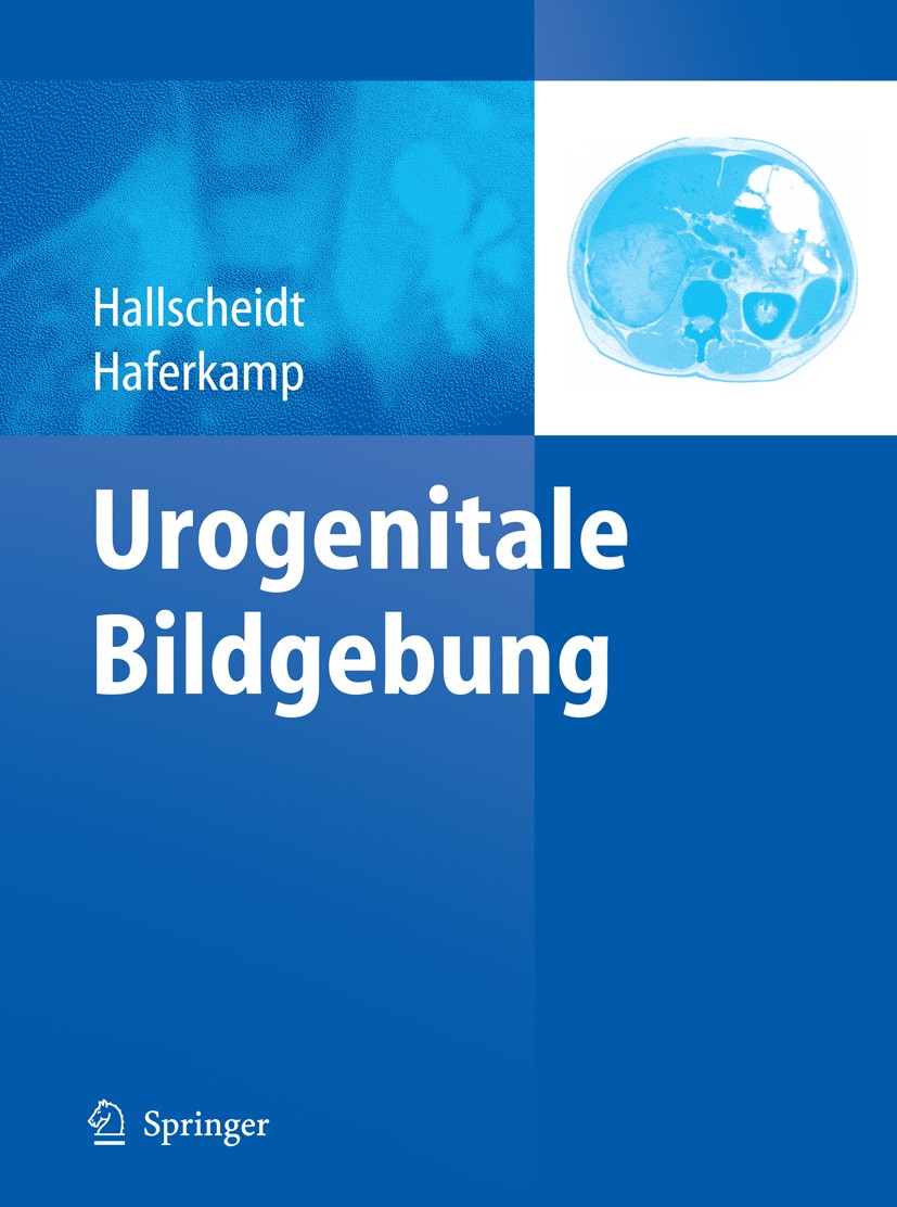 Titlebook: Urogenitale Bildgebung; Peter Hallscheidt,Axel Haferkamp Book 2011 Springer-Verlag Berlin Heidelberg 2011 Urogenitales Imaging.Bildgebung Titlebook: Urogenitale Bildgebung; Peter Hallscheidt,Axel Haferkamp Book 2011 Springer-Verlag Berlin Heidelberg 2011 Urogenitales Imaging.Bildgebung