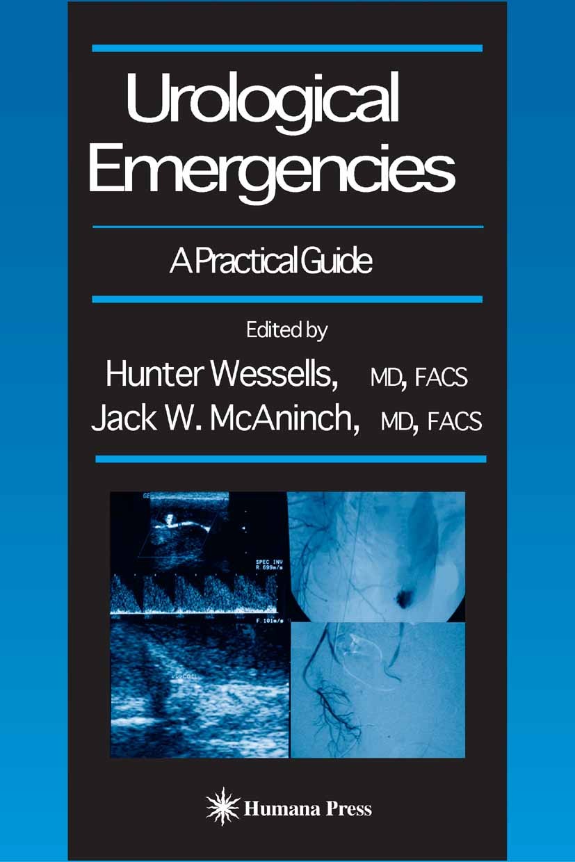 Titlebook: Urological Emergencies; A Practical Guide Hunter Wessells,Jack W. McAninch Book 20051st edition Humana Press 2005 complications.embolism.en Titlebook: Urological Emergencies; A Practical Guide Hunter Wessells,Jack W. McAninch Book 20051st edition Humana Press 2005 complications.embolism.en