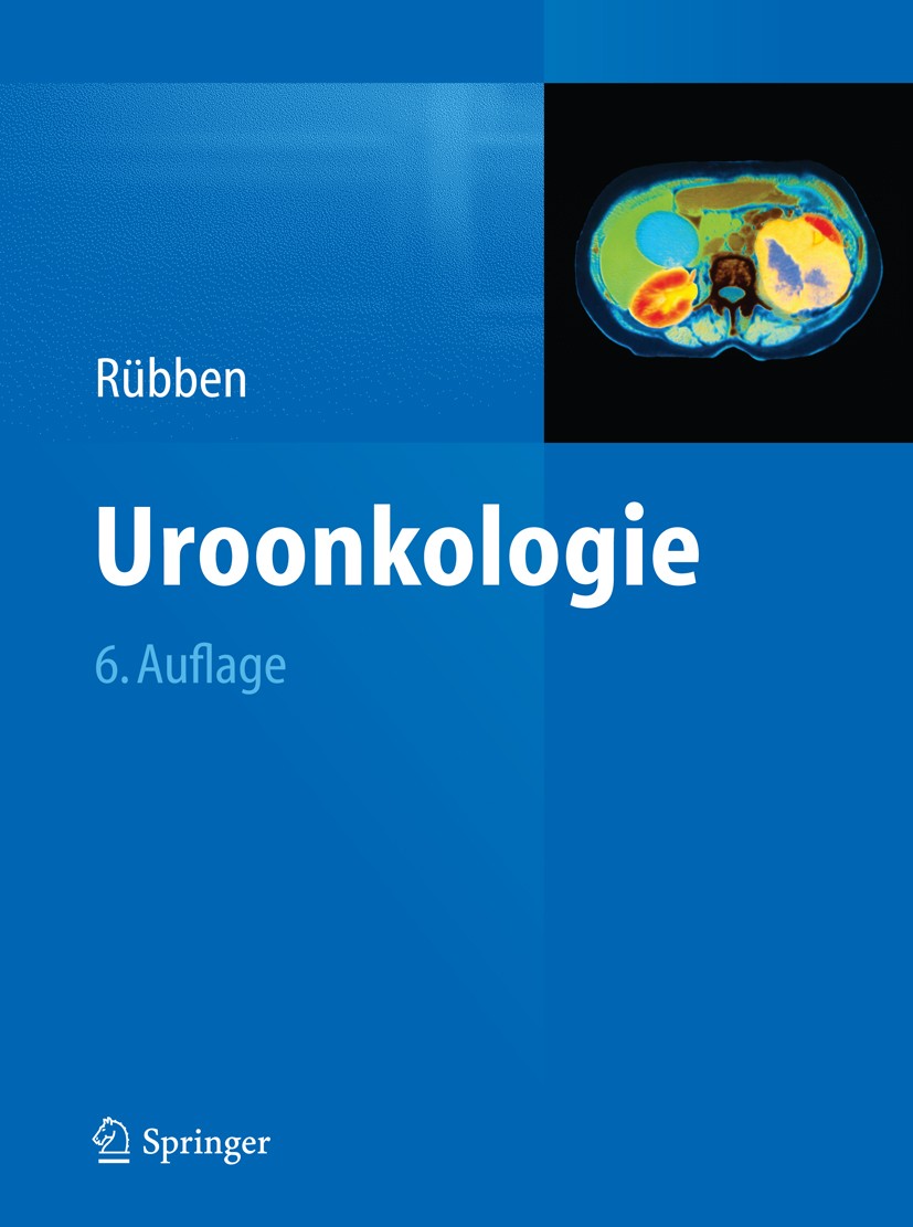 Titlebook: Uroonkologie; Herbert Rübben Book 2014Latest edition Der/die Herausgeber bzw. der/die Autor(en), exklusiv lizenziert an Springer-Verlag Gm Titlebook: Uroonkologie; Herbert Rübben Book 2014Latest edition Der/die Herausgeber bzw. der/die Autor(en), exklusiv lizenziert an Springer-Verlag Gm