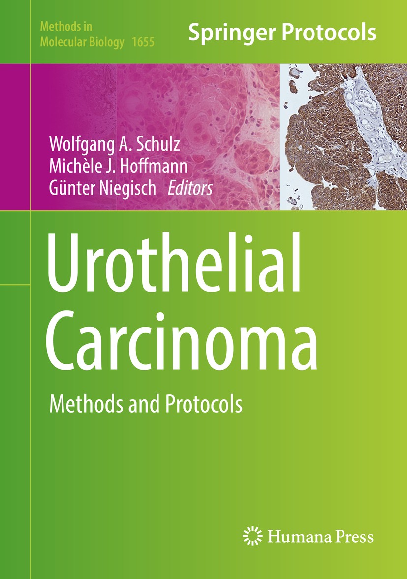 Titlebook: Urothelial Carcinoma; Methods and Protocol Wolfgang A Schulz,Michèle J. Hoffmann,Günter Niegi Book 2018 Springer Science+Business Media LLC Titlebook: Urothelial Carcinoma; Methods and Protocol Wolfgang A Schulz,Michèle J. Hoffmann,Günter Niegi Book 2018 Springer Science+Business Media LLC