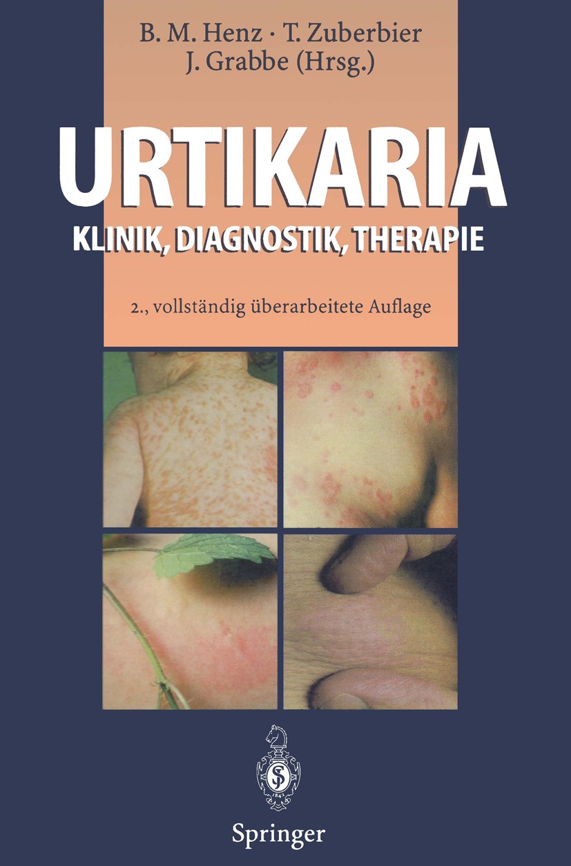 Titlebook: Urtikaria; Klinik, Diagnostik, Beate M. Henz,Torsten Zuberbier,Jürgen Grabbe Book 1996Latest edition Springer-Verlag · Heidelberg 1996 All Titlebook: Urtikaria; Klinik, Diagnostik, Beate M. Henz,Torsten Zuberbier,Jürgen Grabbe Book 1996Latest edition Springer-Verlag · Heidelberg 1996 All